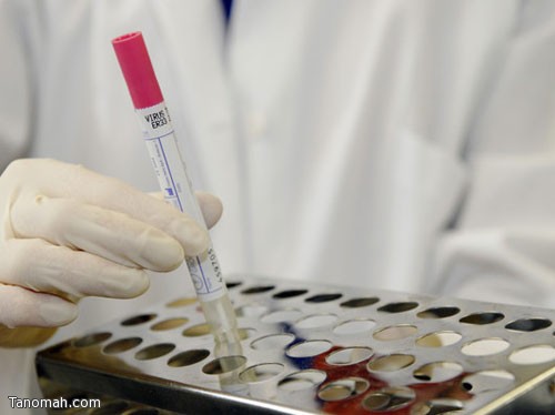 وزارة الصحة : استمرار انخفاض تسجيل حالات الإصابة بفيروس كورونا للأسبوع الخامس على التوالي