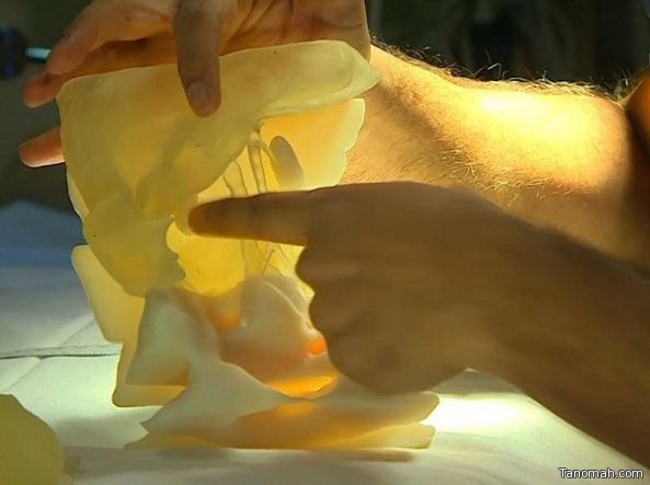 باحثون يطورون طريقة لطباعة العظام والعضلات بتقنية 3D تمكّنها أن تحيا داخل الجسد بعد زراعتها