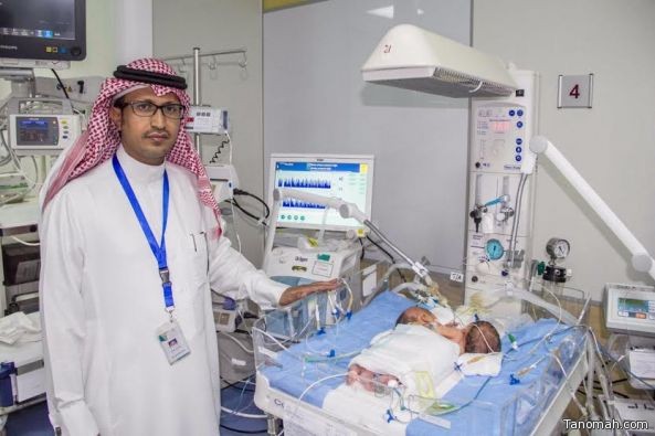 ولادة توأم سيامي "يمني الجنسية" بمستشفى أبها للولادة والأطفال
