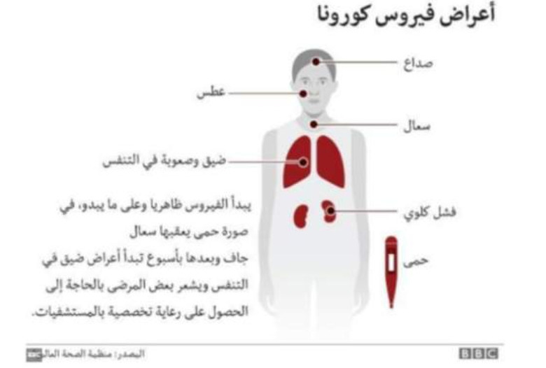 علماء يطورون نسخة من فيروس #كورونا للعلاج منه