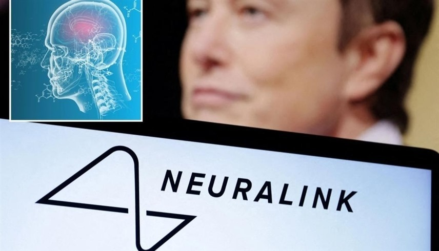 شركة إيلون ماسك تحصل على موافقة بدء التجارب السريرية للشرائح الإلكترونية الدماغية على البشر