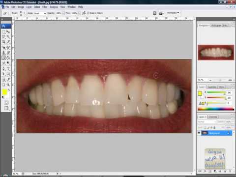 الدرس السابع فوتوشوب تبييض الأسنان و إزالة الحبوب 1-5 