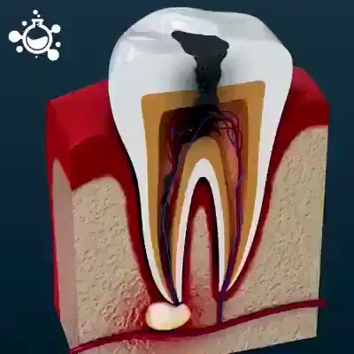 فيديو يلخص لك عمل طبيب الأسنان